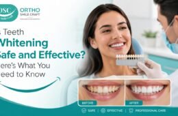Is Teeth Whitening Safe and Effective? Here’s What You Need to Know